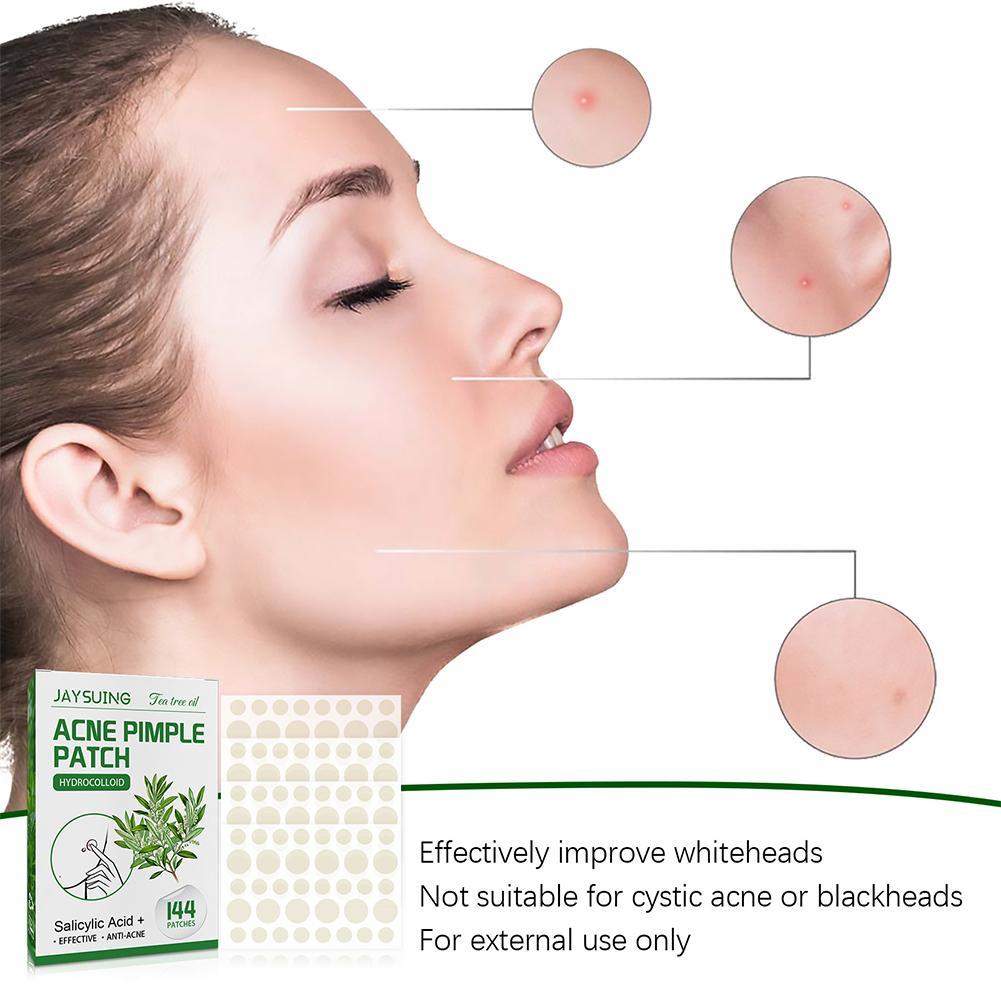 144pcs Acne Pimple Patches Tra - огляд і ціна Herbal Wellness Tea